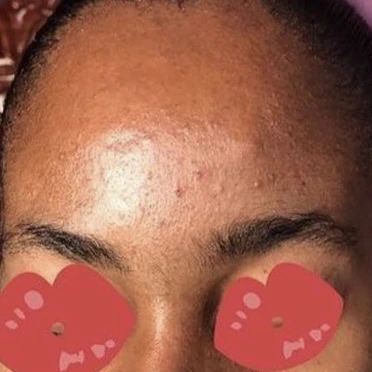 Client result 3 before using KlutchJa Organics products
